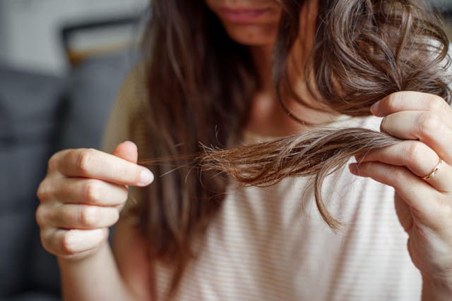<p>La caída del cabello puede presentarse 12 semanas después del factor desencadenante  (Alamy/PA)</p>
