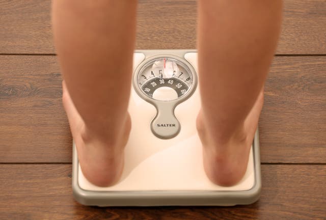 <p>The NHS is using new scales as part of an initiative to tackle childhood obesity</p>