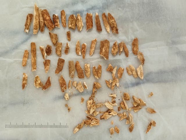 <p>Forearm bone fragments belonging to an ancient child that appeared to have features from both humans and Neanderthals</p>