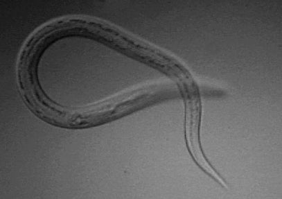 Hookworms affect about 470 million people worldwide, but are rare in the UK