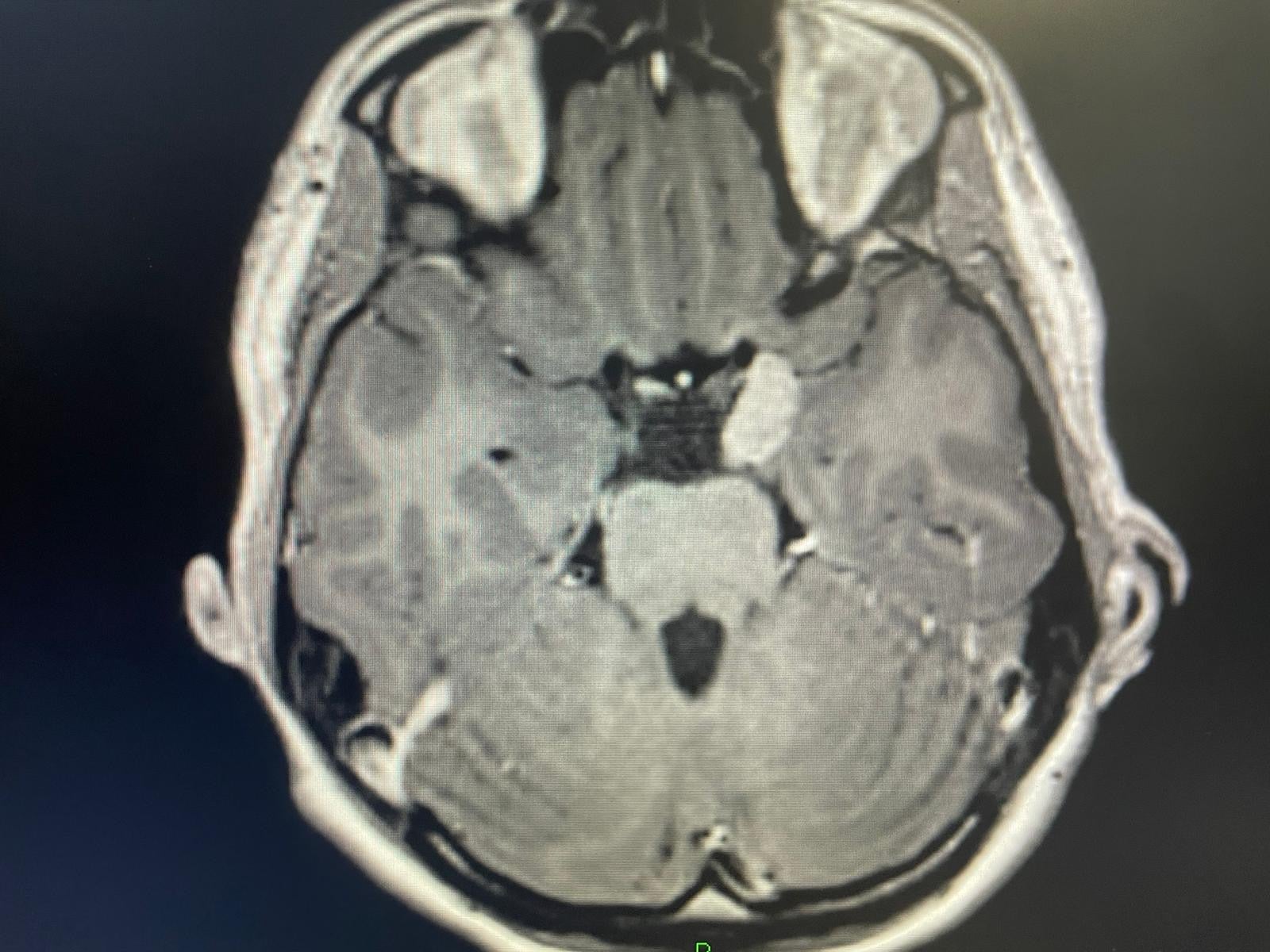 Kerr’s brain scan