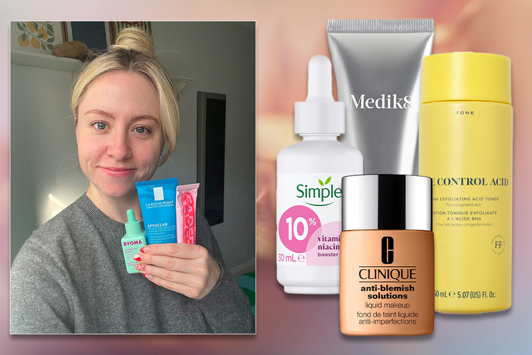 Best blackhead treatments for 2025, tested by an expert | The Independent