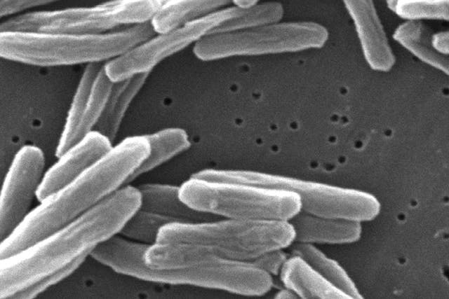 US TB Tuberculosis