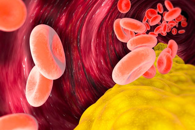 <p>An illustration of cholesterol formation, fat, artery, vein, heart.</p>