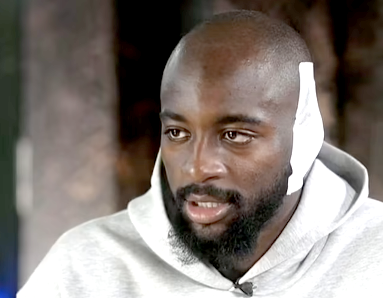 Jean-Philippe Mateta was seen with a bandage during an inteview with Sky Sports