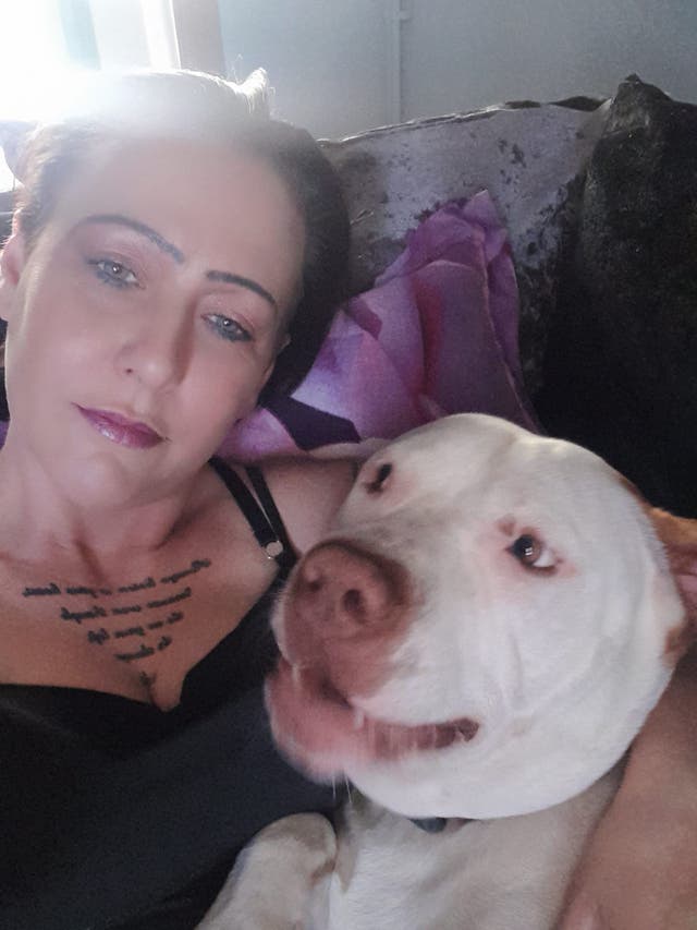 <p>Summer Trezise with her dog Marshall, who says they were both attacked by a dog in a front garden in Burnley</p>