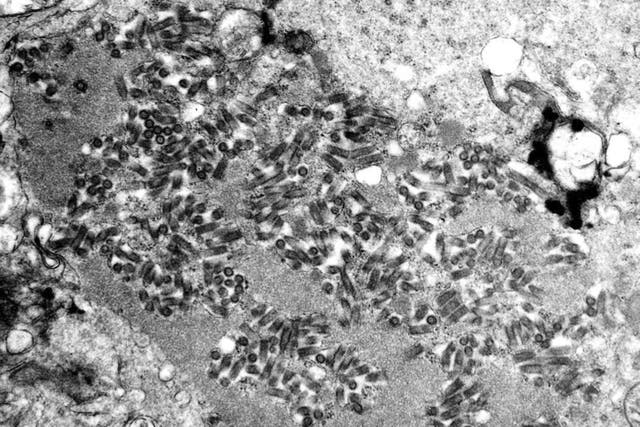 Transplant Death-Rabies
