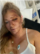 Virginia Giuffre, who claimed abuse by Prince Andrew and Jeffrey Epstein, says she has days to live after car wreck