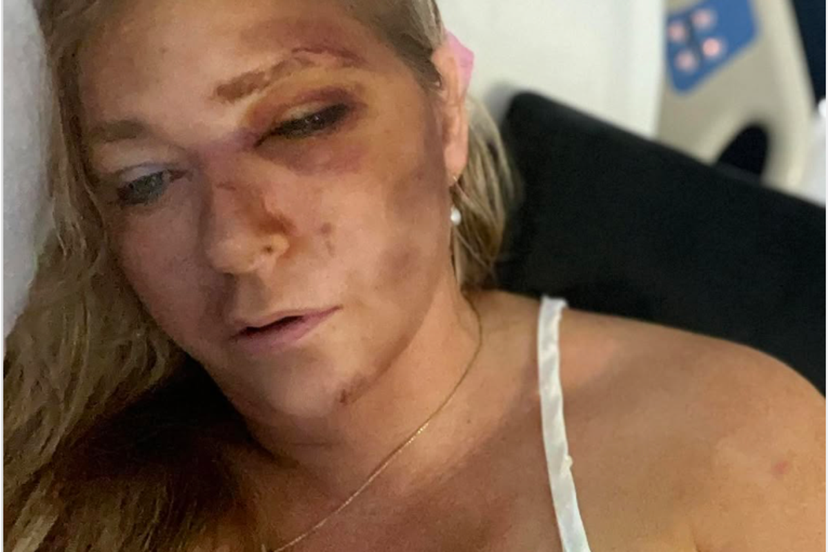 Virginia Giuffre's rep says Epstein victim remains in serious condition -  as reports tie her car wreck to 'minor' crash | The Independent