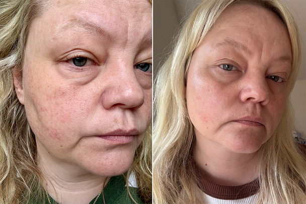 Before and after The Inkey List exosome hydro-glow complex