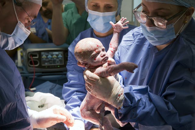 <p>Amy was delivered at Queen Charlotte’s and Chelsea Hospital (Womb Transplant UK/PA)</p>