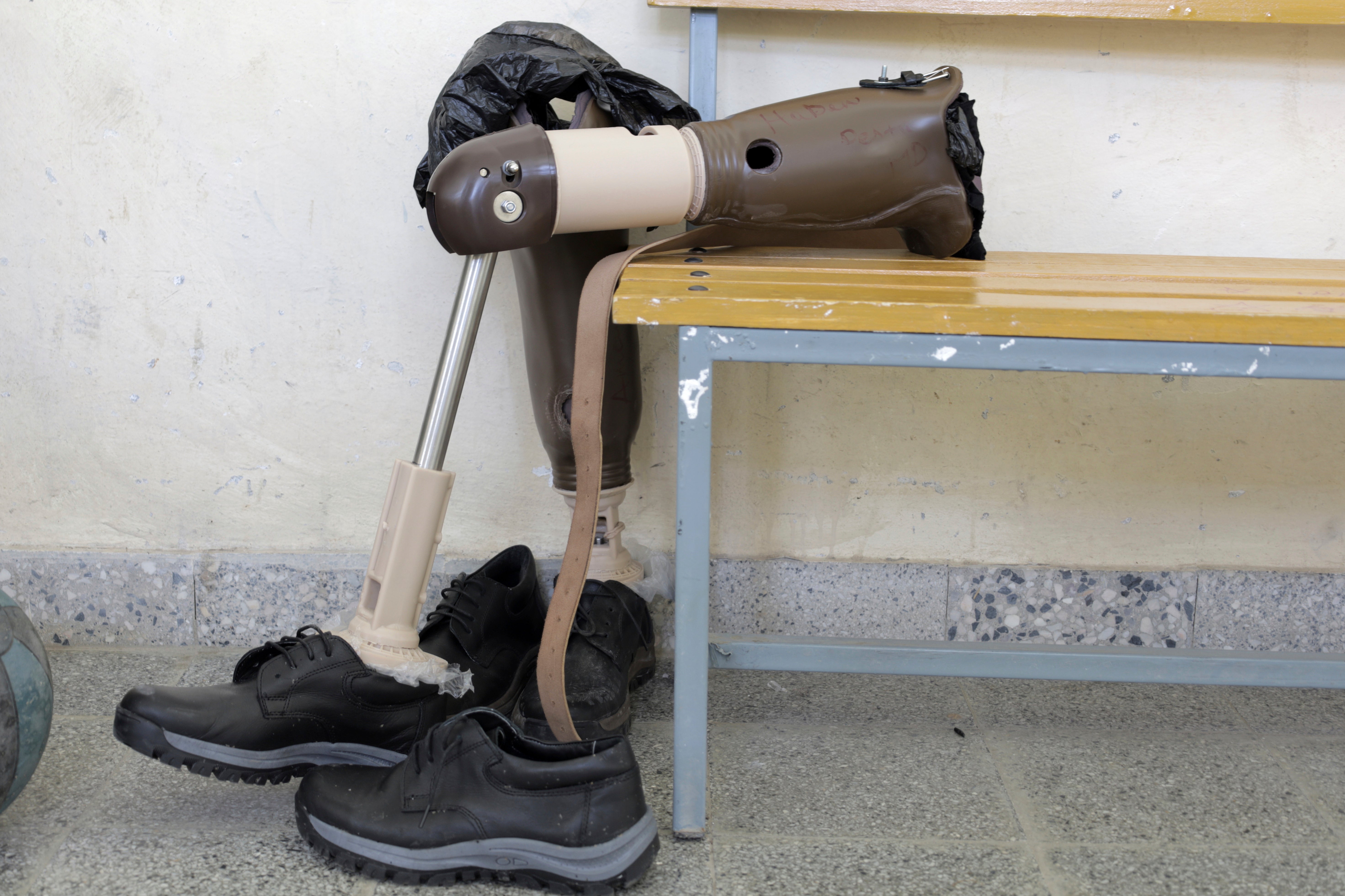 <p>In the study, patient’s brains were scanned with functional magnetic resonance imaging before the amputation and repeatedly afterwards </p>