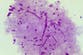 NHS offers world-first vaccine to combat rise in gonorrhoea