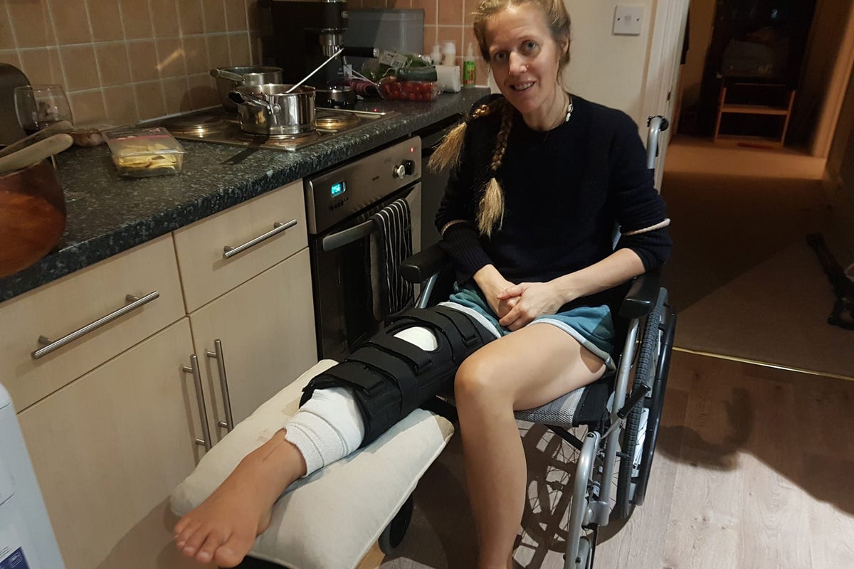 ‘Active’ mum has leg amputated after discovering tumour on run ‘Active’ mum has leg amputated after discovering tumour on run