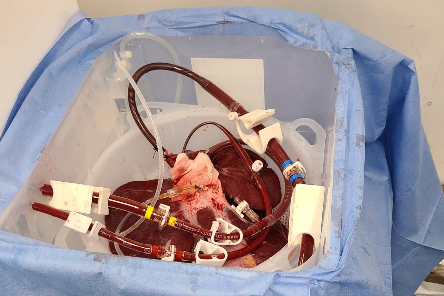 HÍGADO DE CERDO-DIÁLISIS