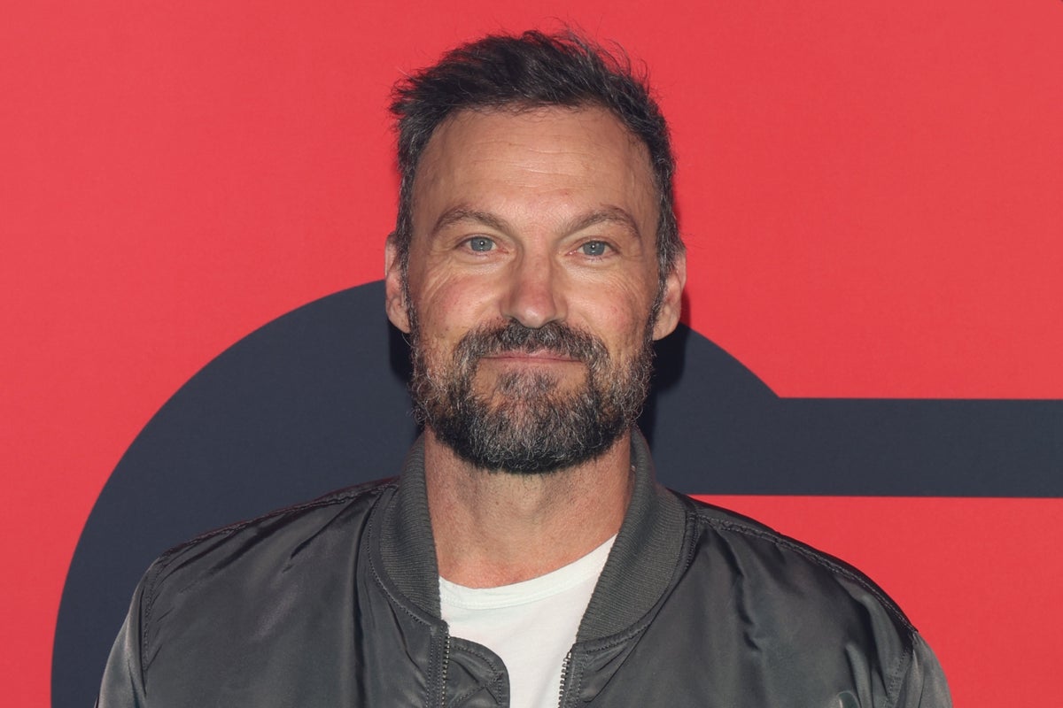 Brian Austin Green recovering after undergoing emergency surgery for perforated appendix
