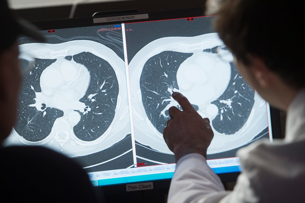How to detect the earliest warning sign of cancer