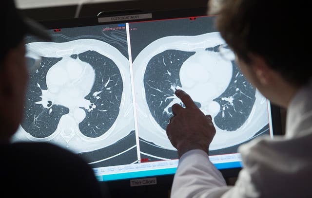 <p>Screening is the only way to detect stage 0 cancers</p>