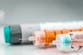 What is Type 5 diabetes? New form of disease recognised after decades of debate