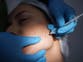 String of negative reactions to aesthetics procedures prompts health chiefs to issue warning