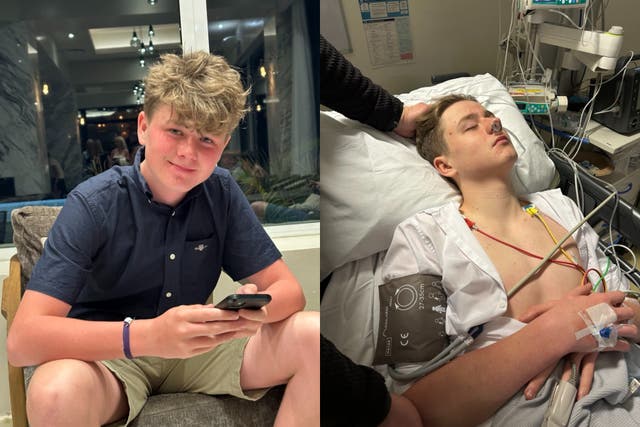 <p>Callum Stone, 15, was diagnosed with a brain tumour earlier this year</p>