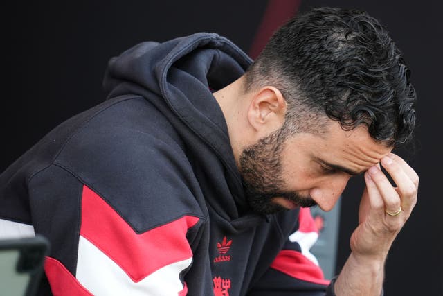 Ruben Amorim reassured Manchester United fans they can eventually regain their superiority over Liverpool (Adam Davy/PA)