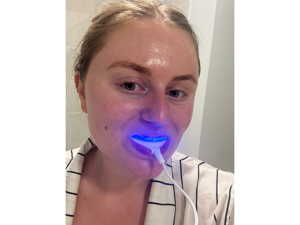 Colgate testing best teeth whitening kits review indybest
