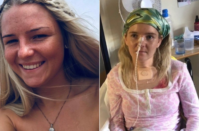 <p>Summer Clarke suffered from a stroke at 24-years-old after a spontaneous brain haemorrhage</p>