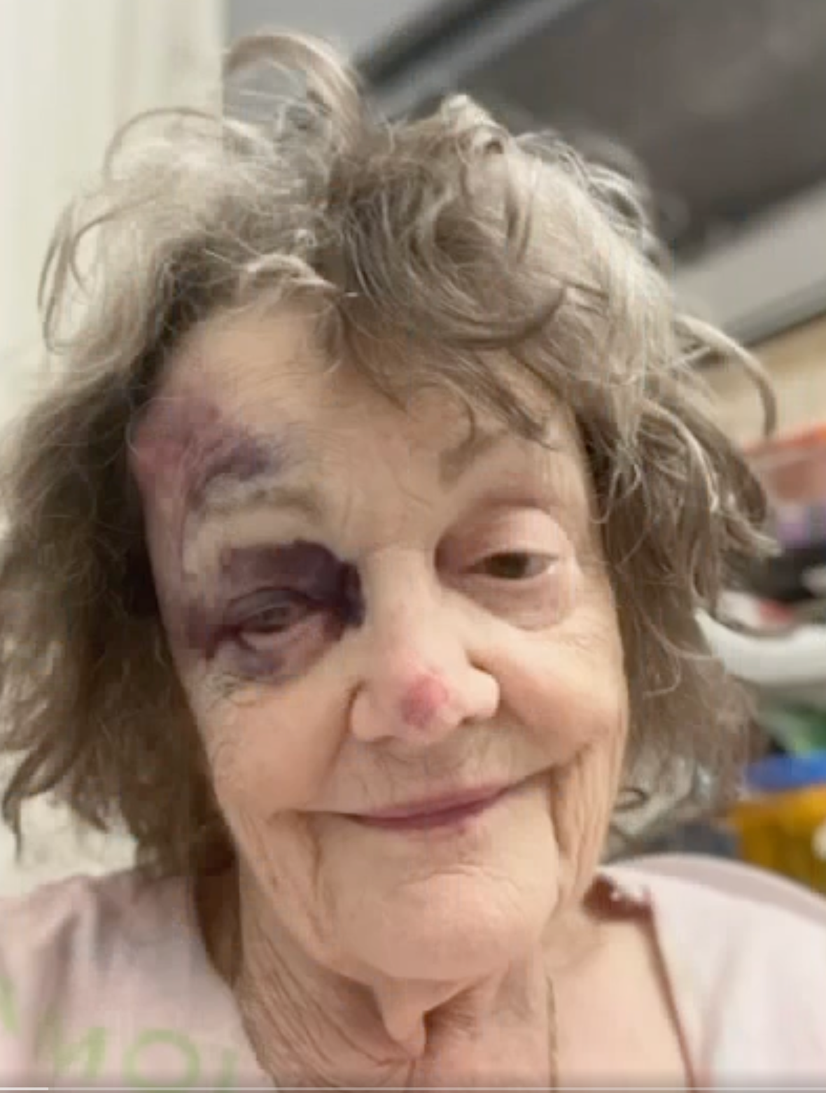 Sandra Glenn says she was knocked down while a man robbed her keys and stole her car. She was sent to the hospital as a result