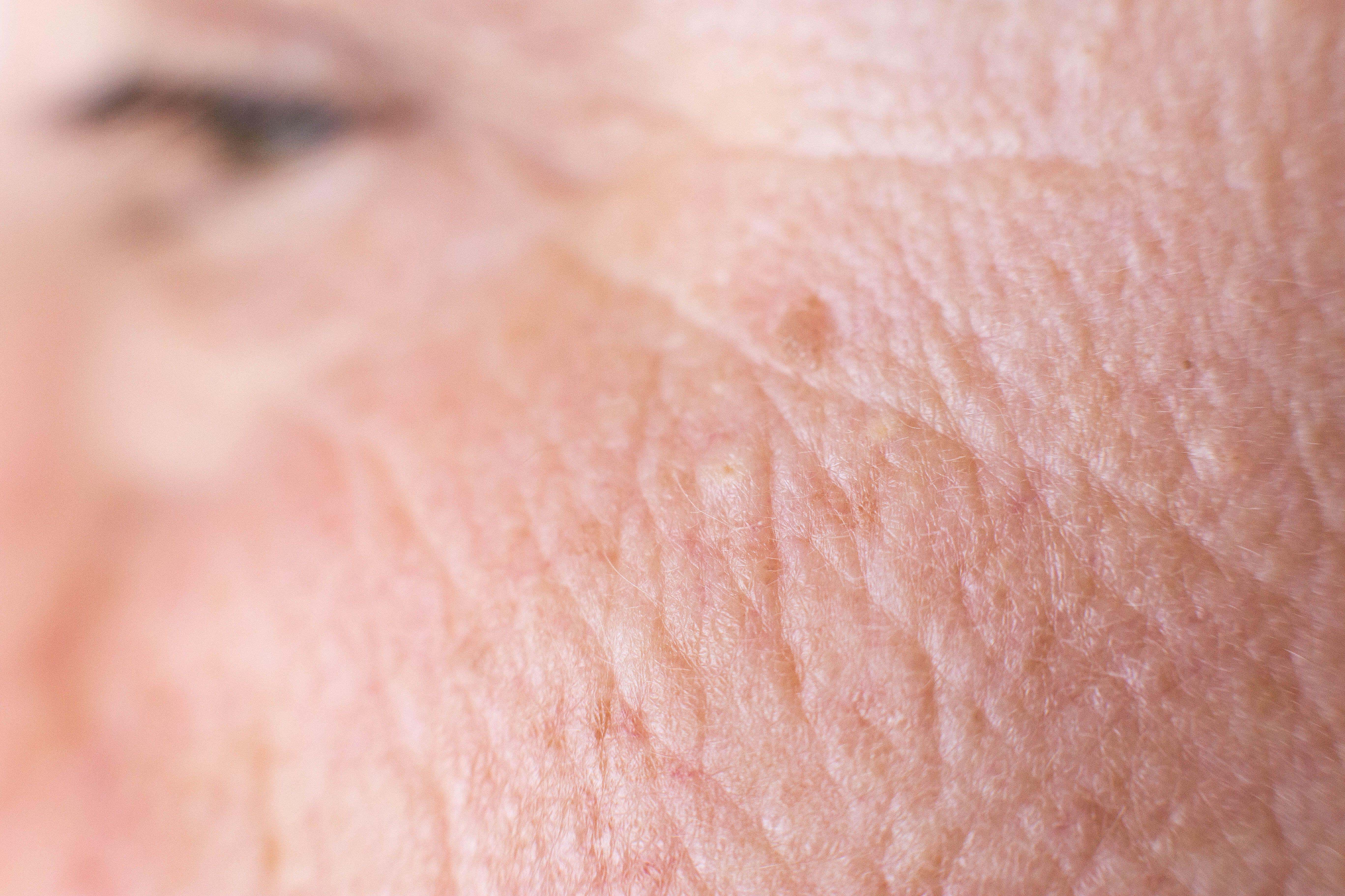 Melan can be identified by a simple test