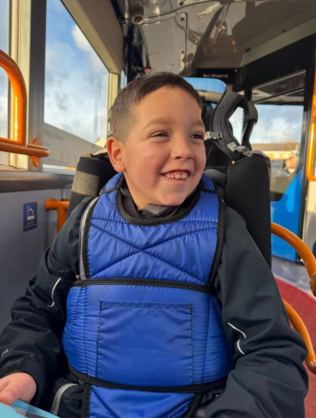 <p>Albie Kelly’s life has been transformed by a drug trial at Sheffield Children’s Hospital</p>