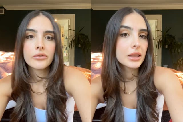 <p>Sophia Umansky said she’s ‘noticed a dramatic <a href="/topic/hair-loss">hair loss</a> situation’</p>