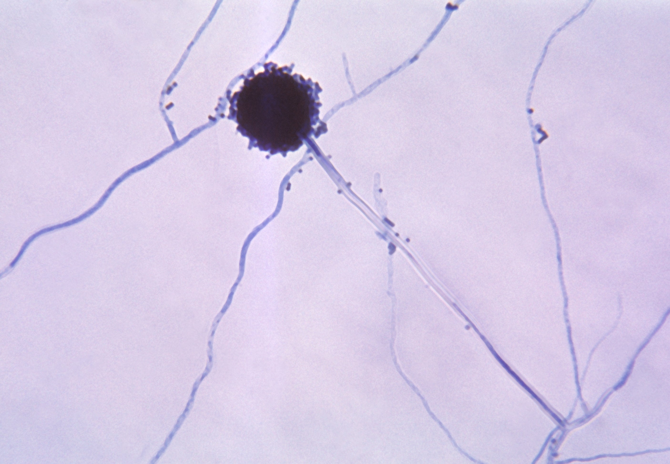 The fungus thrives in humans because it can survive in warm temperatures