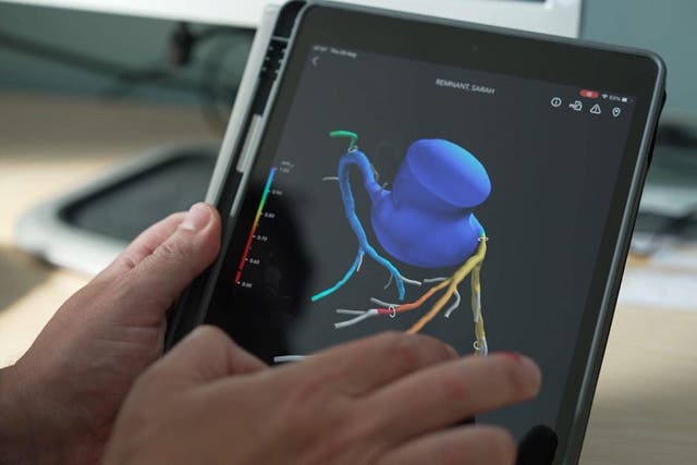 A heart flow scan of a coronary heart disease sufferer Sarah Remnant (NHS England/PA)