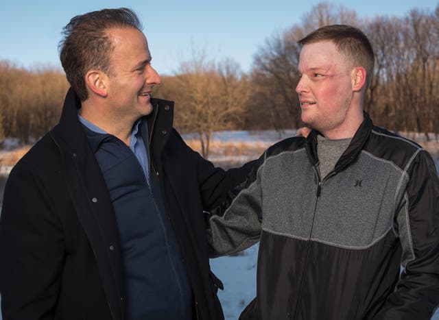 He received the gift of someone else’s face in a 56-hour surgery. What ...