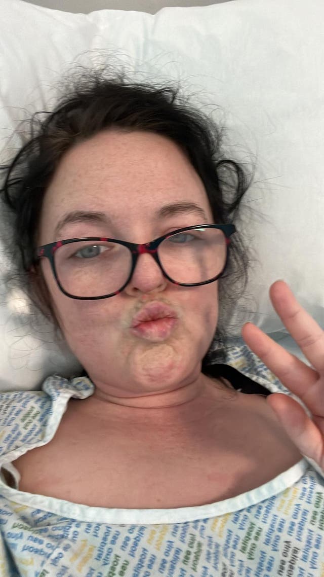<p>Julie in hospital the day after her operation</p>