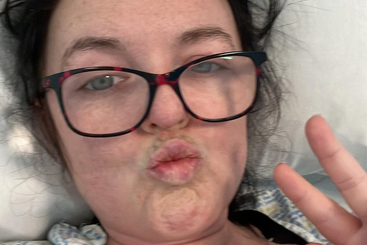 Mum discovers spinal tumour before wedding after ‘10 years of back pain’ Mum discovers spinal tumour before wedding after ‘10 years of back pain’