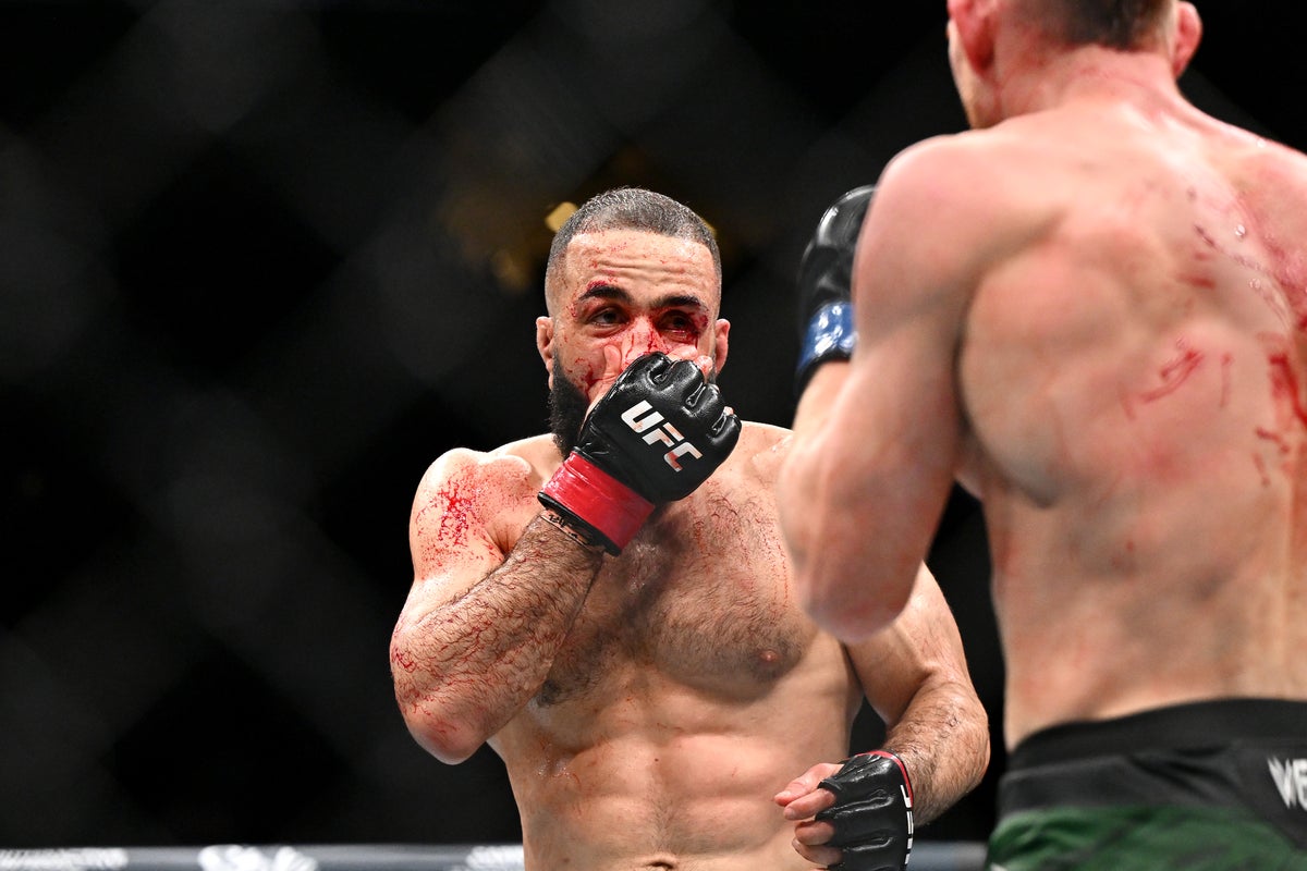 Belal Muhammad’s UFC 315 injuries made clear in gruesome photos Belal Muhammad’s UFC 315 injuries made clear in gruesome photos