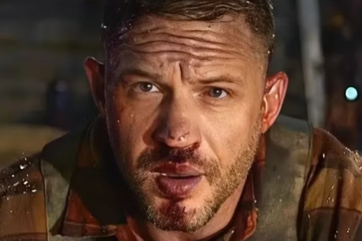 Tom Hardy says his body is ‘not going to get better’ after revealing painful film injuries