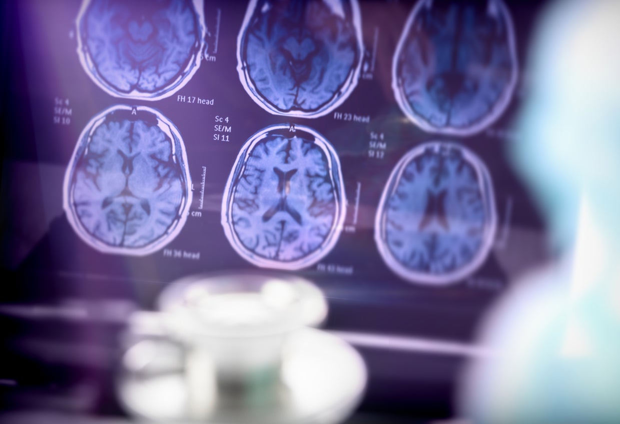 Previous research has tied sitting to dementia. Furthermore, older people who sat for more than 10 hours a day were found to have a higher risk of developing Alzheimer’s disease