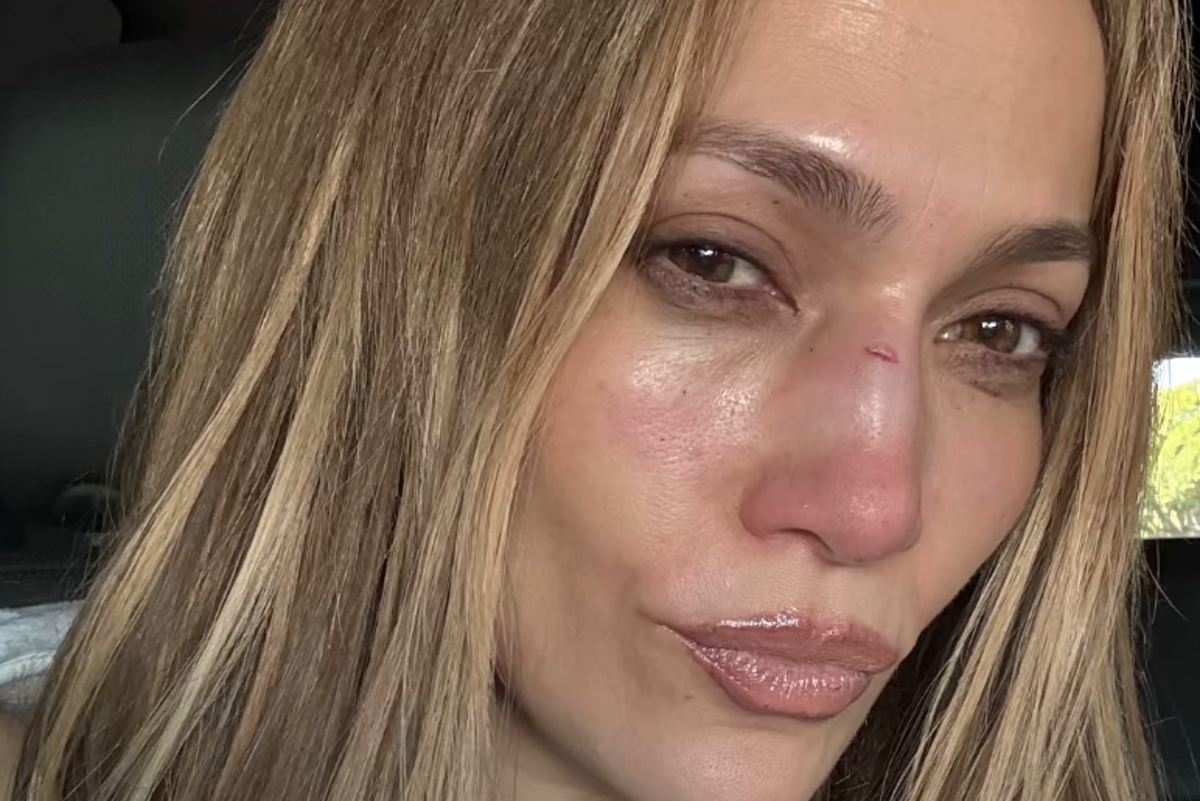 Jennifer Lopez gives health update after onstage injury that led to facial ‘stitches’