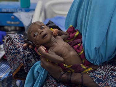 <p>A malnourished child receives treatment in Maiduguri, northeastern Nigeria</p>