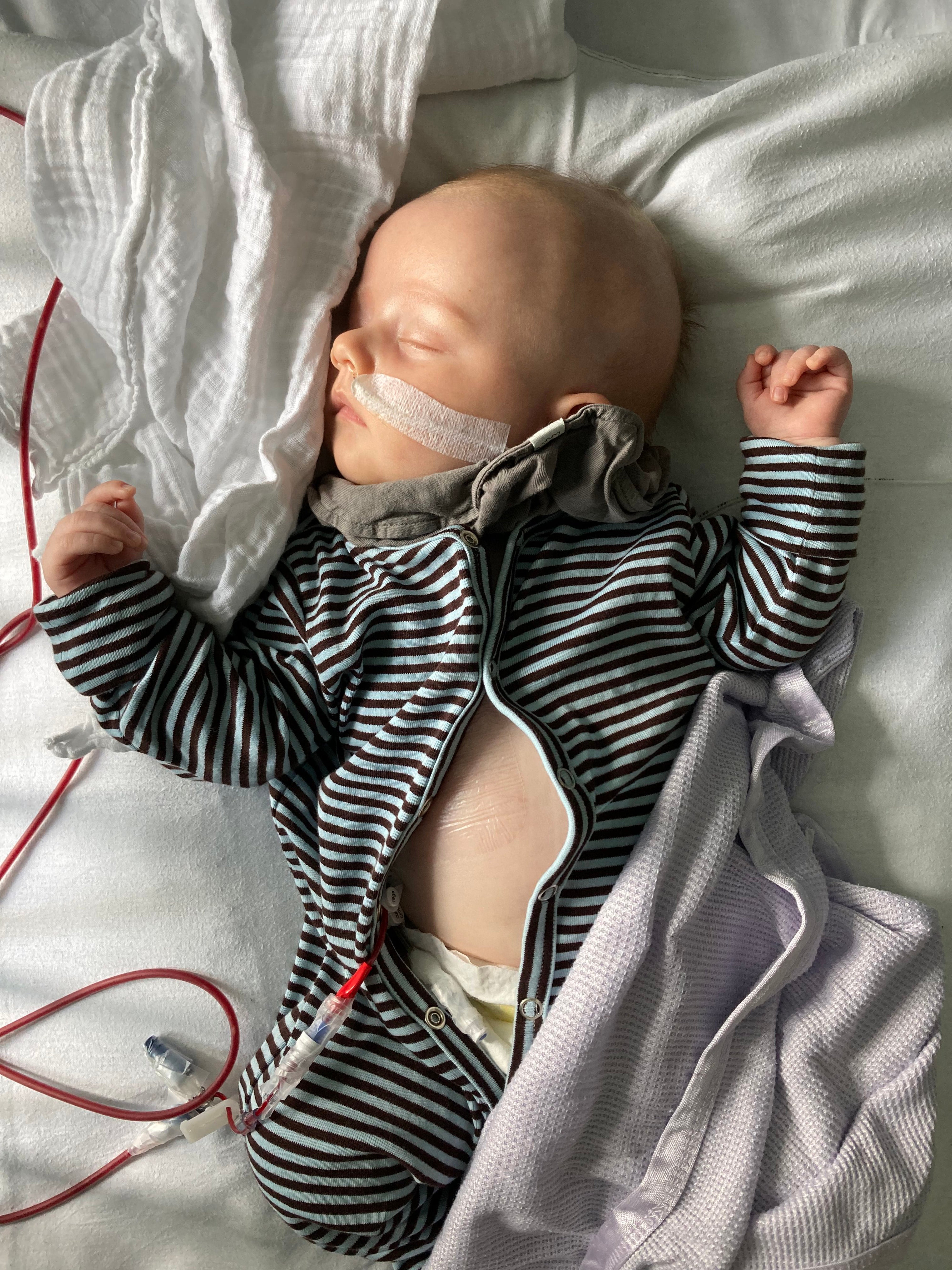 Nelson receiving his transplant