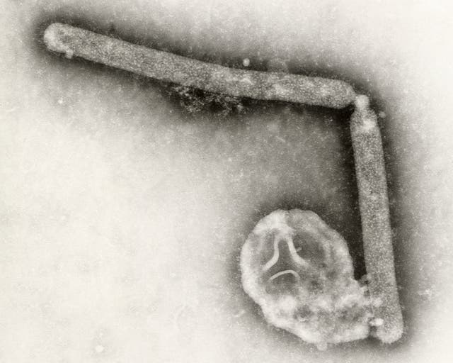 <p>This undated electron microscopic image provided by the Centers for Disease Control and Prevention shows two Influenza A (H5N1) virions, a type of bird flu virus</p>