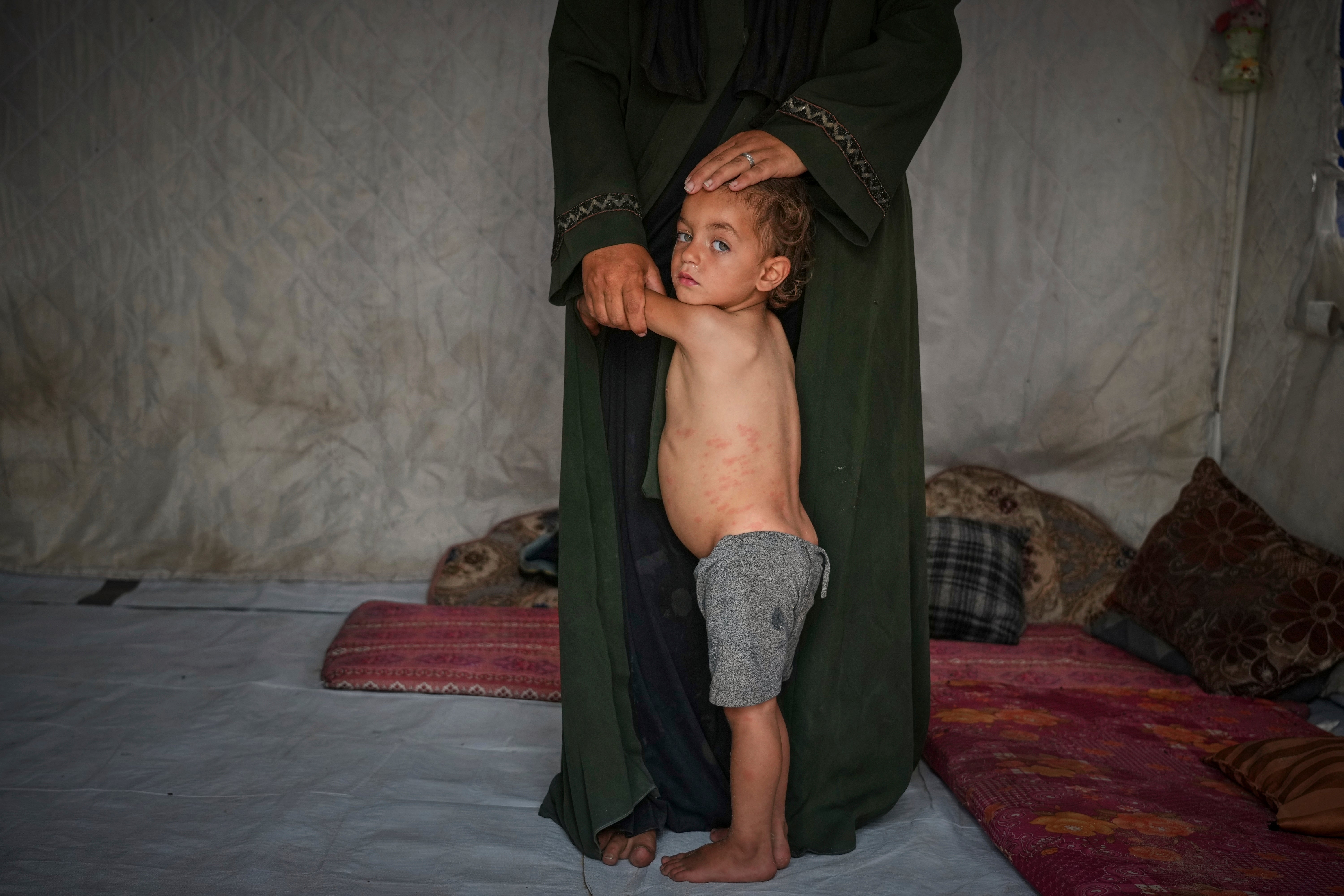 Mohammed Abu Hilal, 2, clings to his mother, Yasmine, inside their tent at the Muwasi camp in Khan Younis, southern Gaza Strip, Sunday, May 18, 2025