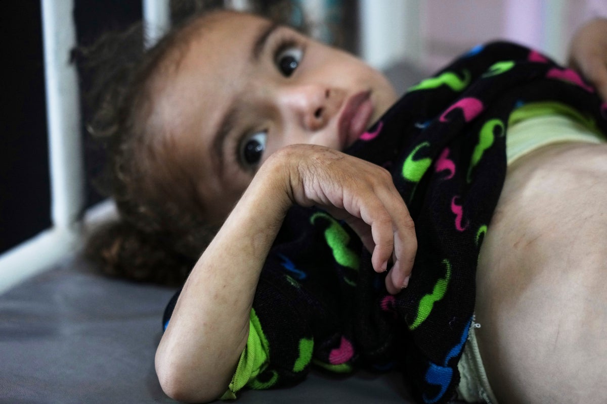 Mothers and their babies face starvation in Gaza, where hospitals are overwhelmed