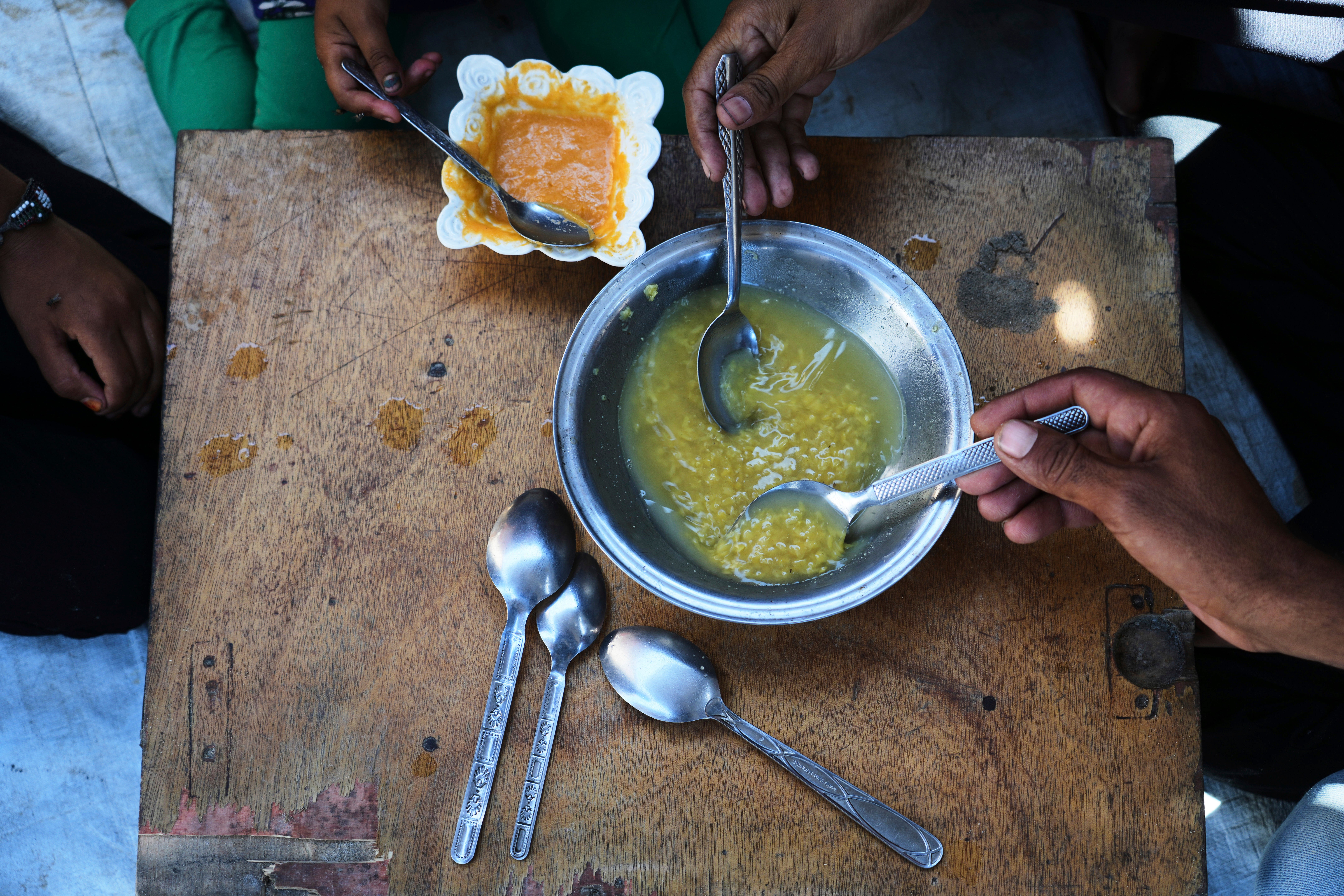 Mideast Wars Gaza Malnutrition