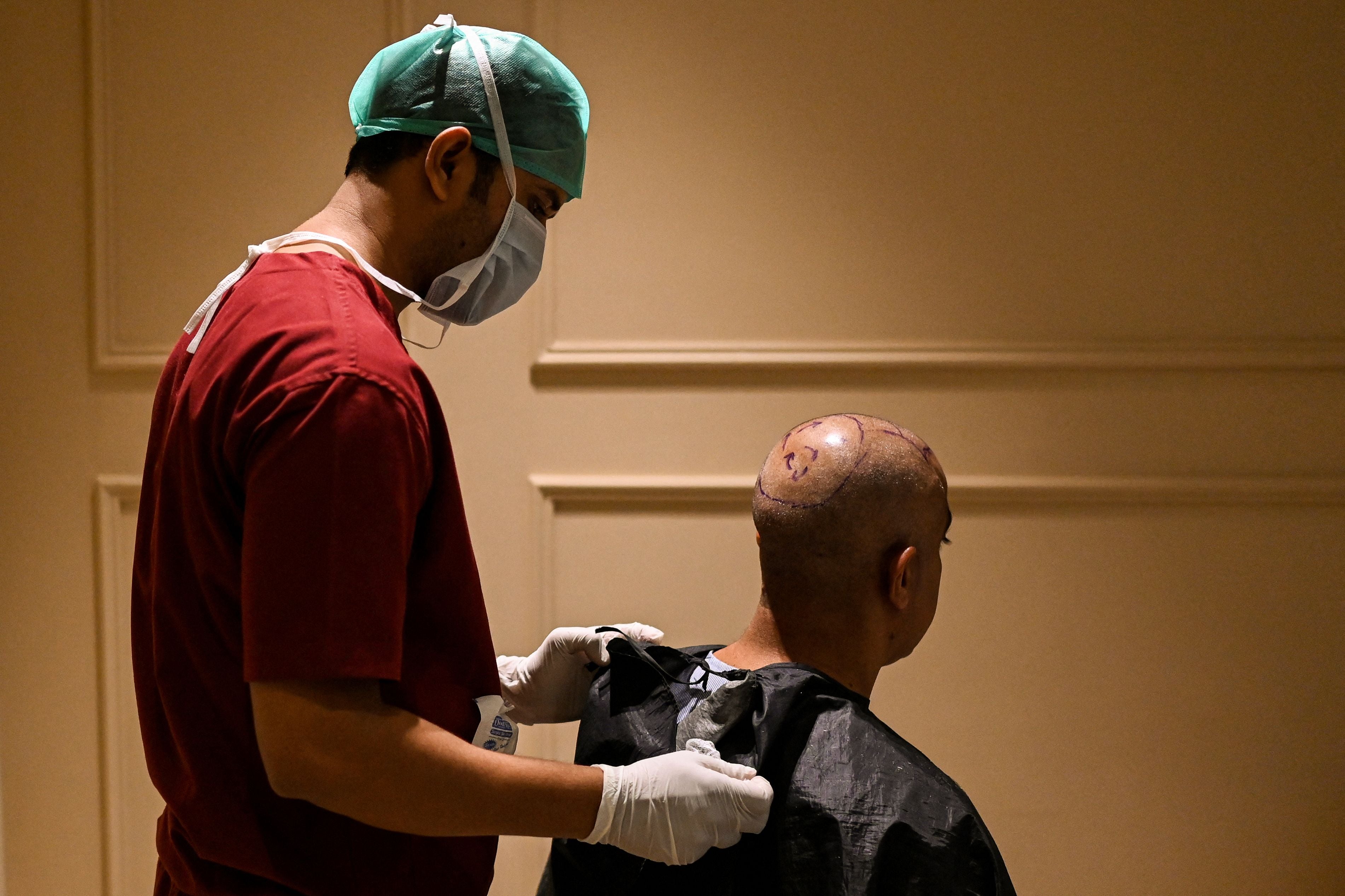 Representative: An operation theatre technician (OT) attends a patient before a hair transplant patient
