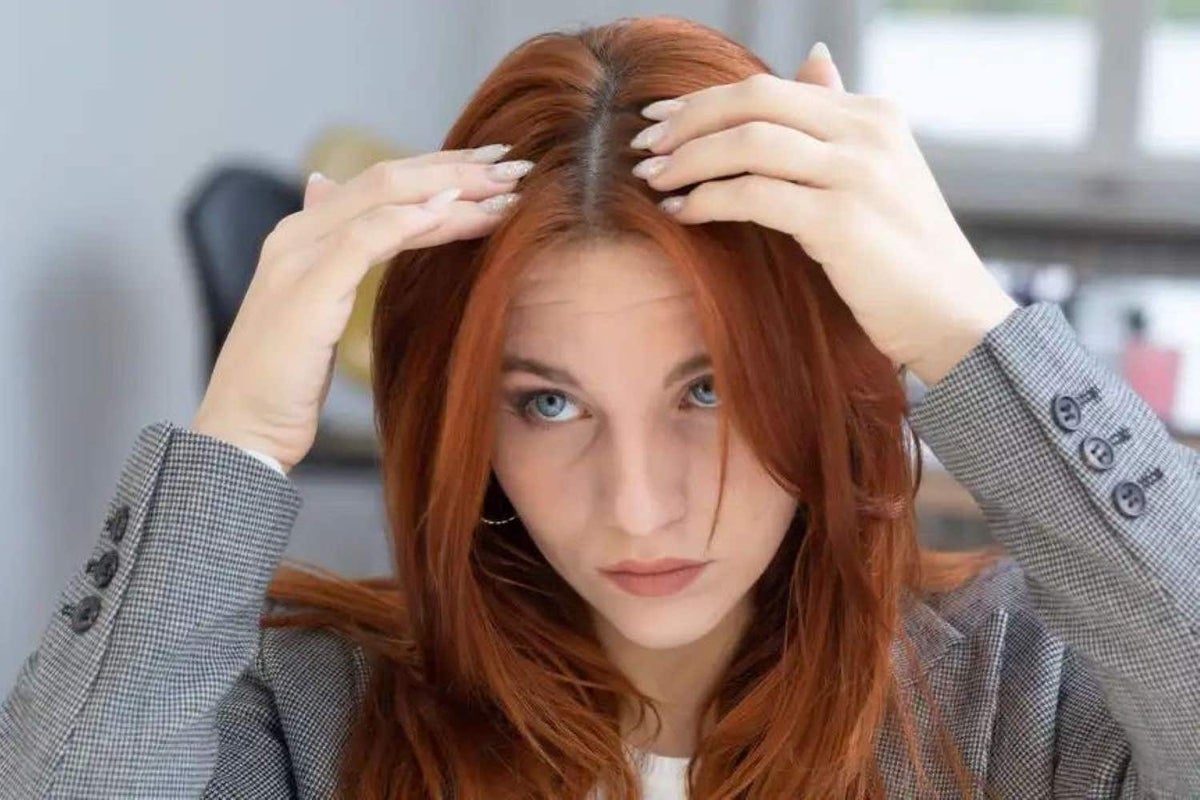 What causes dandruff – and what is the best way to prevent it?