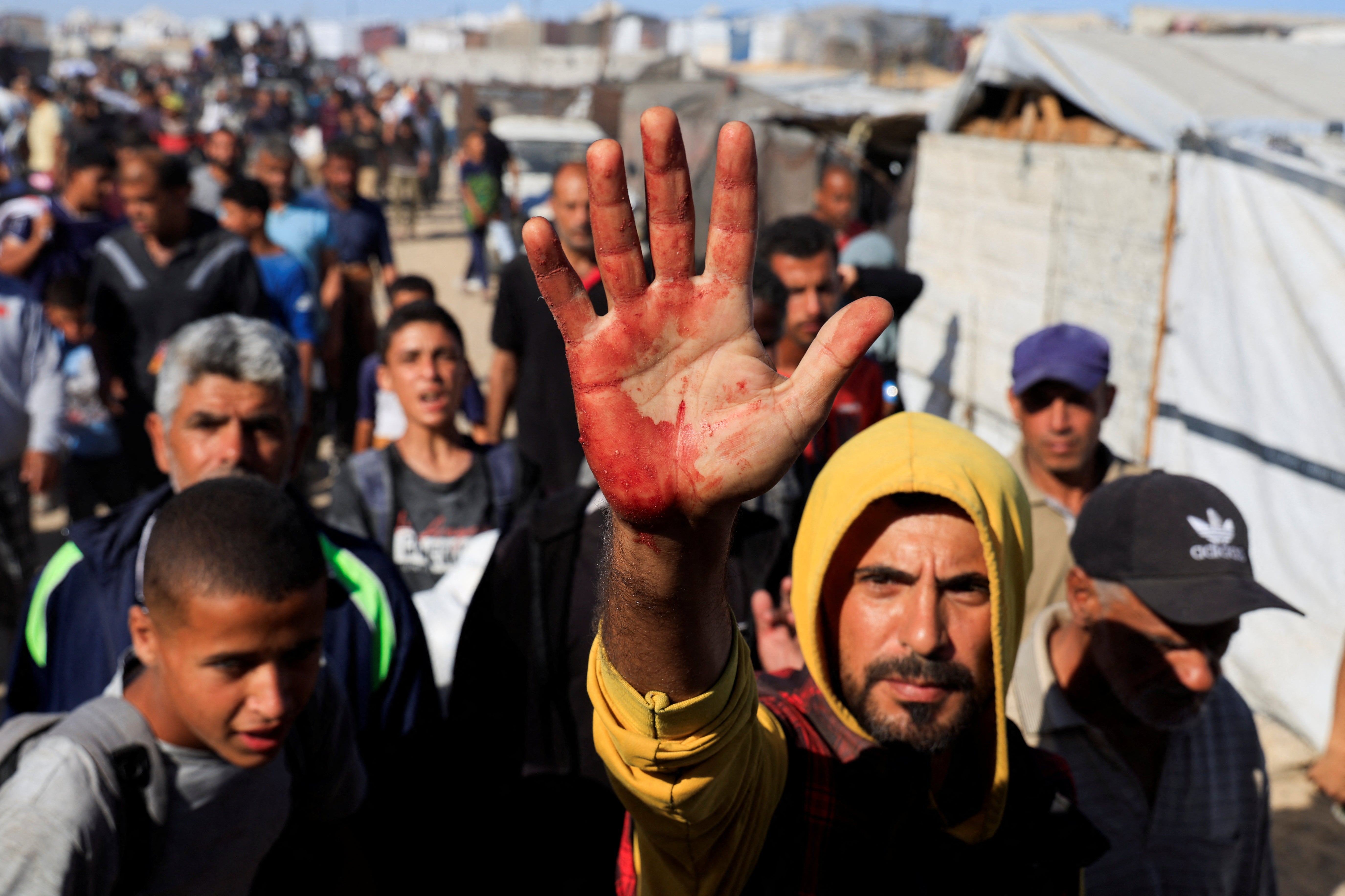 A Palestinian man shows blood stains on his palm, after collecting aid supplies from the U.S.-backed Gaza Humanitarian Foundation